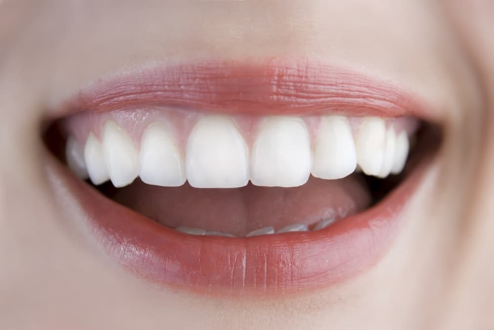 lach-1000x667 De mondhygiënist zorgt ervoor dat uw lach gezond blijft